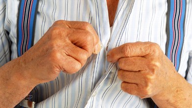 PHOTO: Elderly man in braces buttoning up his shirt.