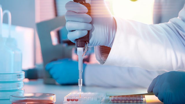 PHOTO: A new study found a synthetic protein may help fight the flu before it starts.