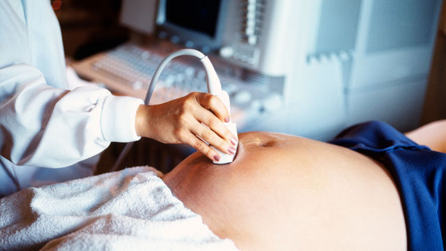 PHOTO: A Dominican teenager was denied treatment for Leukemia because she was pregnant and abortion is illegal in the Dominican Republic.