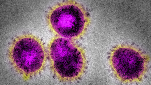 PHOTO: Electron micrograph of Coronavirus, the cause of Severe Acute Respiratory Syndrome, SARS.