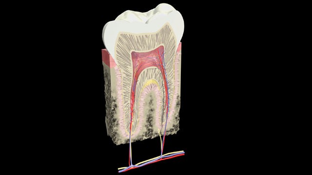PHOTO: Dentists are now detecting microcavities with technology far more sensitive than the X-ray really need to be treated.