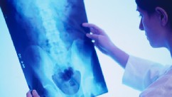 PHOTO: Back x-ray