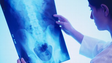 PHOTO: Back x-ray