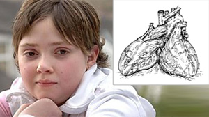 heart transplant
