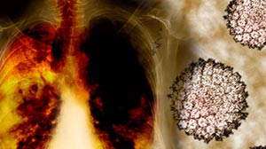 HUMAN PAPILLOMAVIRUS