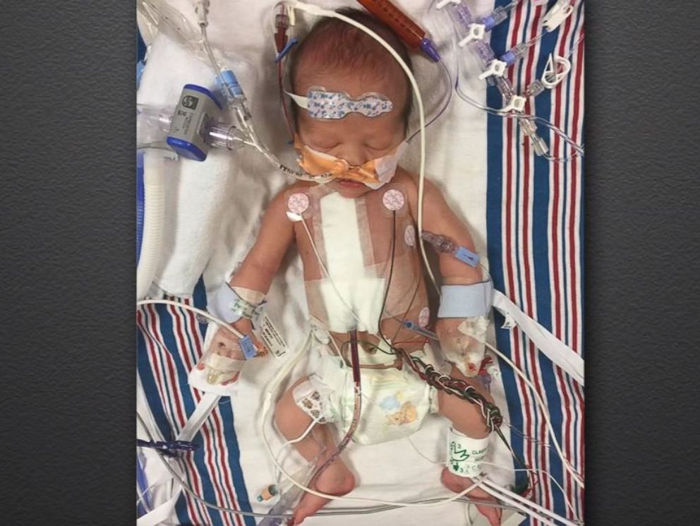 PHOTO: Jimmy Kimmel opens up about newborn sons heart condition on Jimmy Kimmel LIve!.