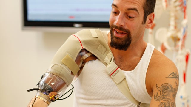 PHOTO:&nbsp;Glen Lehman testing a "bionic arm" at the Rehabilitation Institute of Chicago's Center for Bionic Medicine.