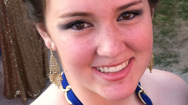 PHOTO: Marianna Consiglio, seen here in this undated handout photo, suffered from a severe concussion four years earlier and had debilitating headaches until she underwent nerve surgery at a D.C. hospital in December, 2012. The surgery provided relief, an