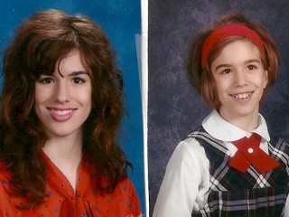 Bald by Middle School, Girl Fights Pathological Grooming