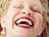 Beauty of Albinism