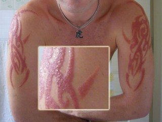 Henna Tattoos Pictures on Revealed From Cell Phones To Henna Tattoos Some Allergies