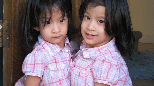 PHOTO: Angelica and Angelina Sabuco, now two years old, were born joined at the chest and abdomen