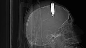 X-Rays oddities