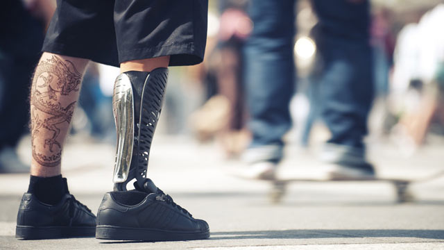 PHOTO: Prosthetic limbs get a personalized makeover.