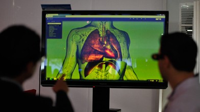 PHOTO: Biodigital Human