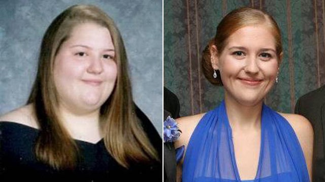 PHOTO: Caitlin Dunnings weighed 361 pounds in high school, but lost 185 pounds after weight loss surgery. Her success inspired two family members to lose weight without surgery.
