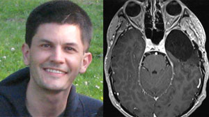 Beating Cancer as a Kid, Only to Fight It Again as an Adult