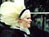 Beauty of Albinism