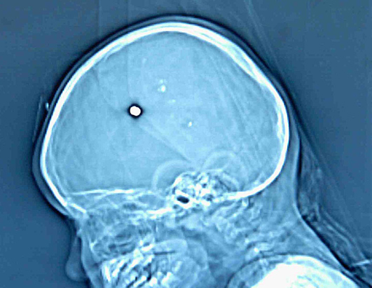 x-ray oddities