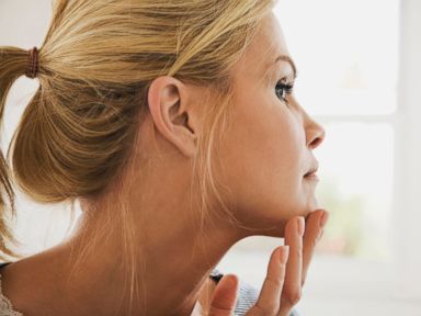 10 Things to Know About Melanoma