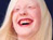 Beauty of Albinism
