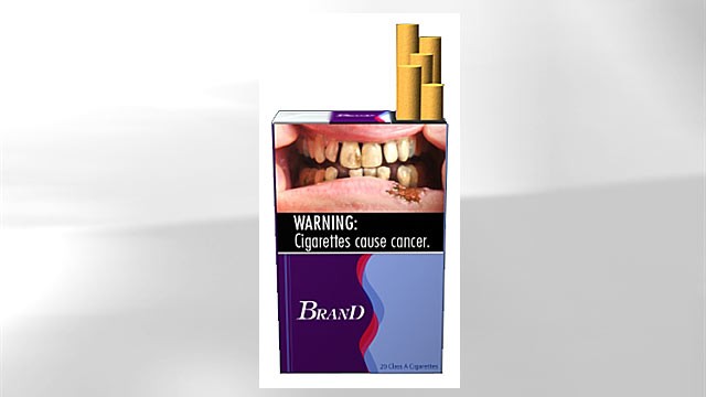 PHOTO: A proposed graphic health warning for cigarette packages and advertisements suggests the increased risk of health problems among smokers by depicting a man who's teeth has decayed.