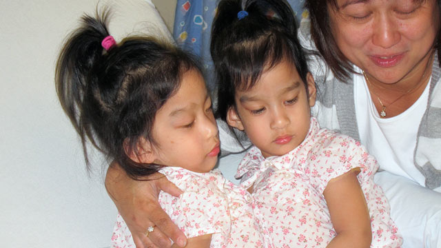 PHOTO: Conjoined twins Angelica and Angelina Sabuco shortly before surgery with their aunt.