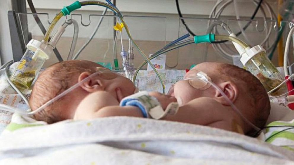 PHOTO: Emmett and Owen Ezell