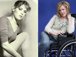 pic of ballerina and chronic pain (Cynthia Beth)