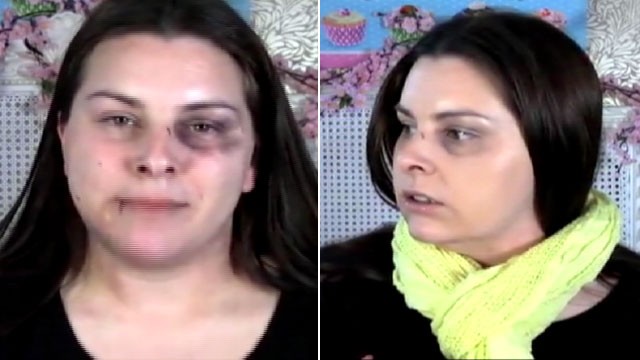 PHOTO: YouTube makeup artist Lauren Luke conceals cuts and bruises for domestic violence PSA.