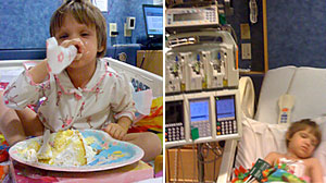 Photo: Fanconi anemia