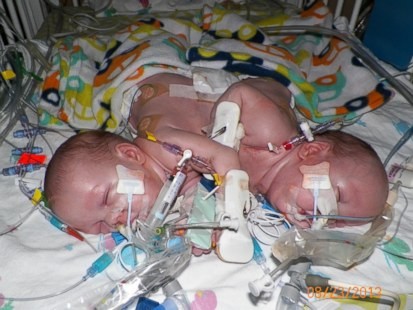 Ezell Twins