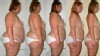 PHOTO: A woman lost 154 pounds on the "K-E Diet," also known as the "Feeding Tube Diet."