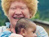 Beauty of Albinism