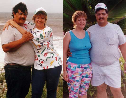 gastric bypass