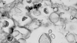 PHOTO A novel strain of the fungus depicted here, Cryptococcus neoformans, has been responsible for a handful of deaths in Oregon, leading scientists to examine whether this new strain is more deadly than others.