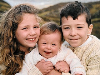 Photo: Down's Syndrome