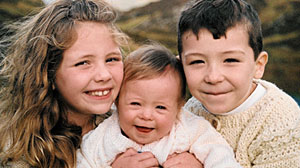 Photo: Downs Syndrome