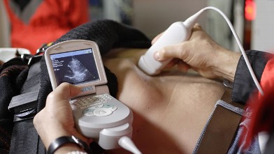 PHOTO: The ACUSON P10? ultrasound system is the first pocket ultrasound device?a handheld diagnostic and screening tool designed for physicians, nurses, EMTs and clinical professionals.