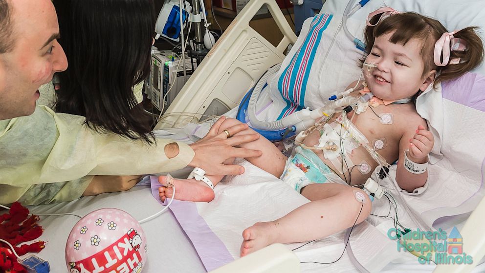 PHOTO: Hannah Warren, 2, was born without a windpipe and received an artificial trachea at OSF Saint Francis Medical Center, Peoria, Illinois.