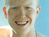 Beauty of Albinism