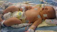 Houston Tracy, 12 days old, was denied health coverage for a pre-existing condition. Doctor discovered a life-threatening problem with his heart when he was born, and after surgery Tracy is expected to fully recover.