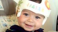 PHOTO Isaiah Regalado, 8 months, wears a Cranial Molding Helmet to correct a misshapen skull.