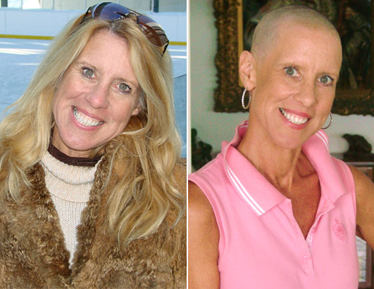 Women Who Say Mammograms Before 50 Saved Their Lives