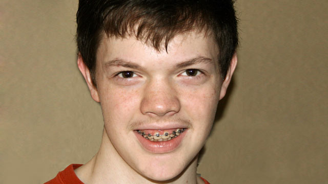 PHOTO: Jonathan Oliphint, 17, has a rare condition known as argininsoccinic aciduria.