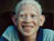Beauty of Albinism