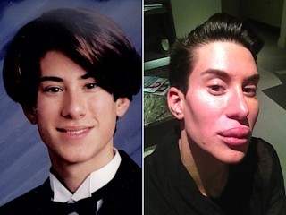 Photos: 7 Shocking Cases of Extreme Plastic Surgery