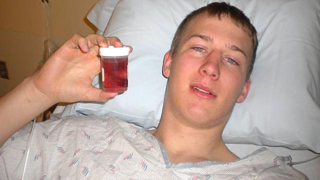 PHOTO: Justin sits in the hospital bed, holding his record-breaking tonsils, after surgery