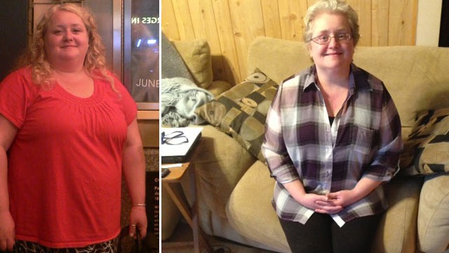 PHOTO: Kathleen Anderson of Chicago quit smoking and lost 100 pounds, but it was a 10-hour surgery that allowed her to breathe again and saved her life.