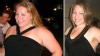 Photo: TEENS WHO GET GASTRIC BANDING ACHIEVE SIGNIFICANT WEIGHT LOSS SAFELY
